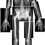 True Life Human X-Rays